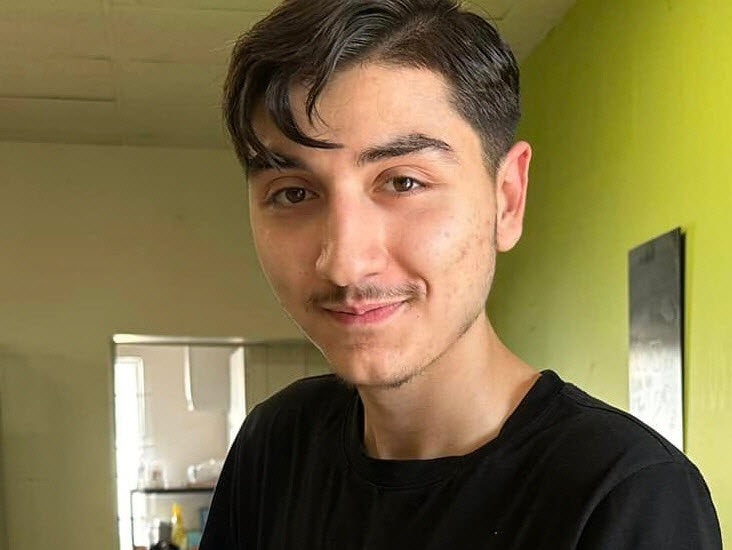 CerfiaFR's tweet image. 🇫🇷 FLASH | 5 personnes ont été placées en garde à vue après la mort de Numan Toprakoğlu, franco-turc de 19 ans, près de Mâcon. Il a été défiguré et battu à mort, vraisemblablement par des coups de machette.

Plus de 800 personnes se sont réunies pour lui rendre hommage hier.