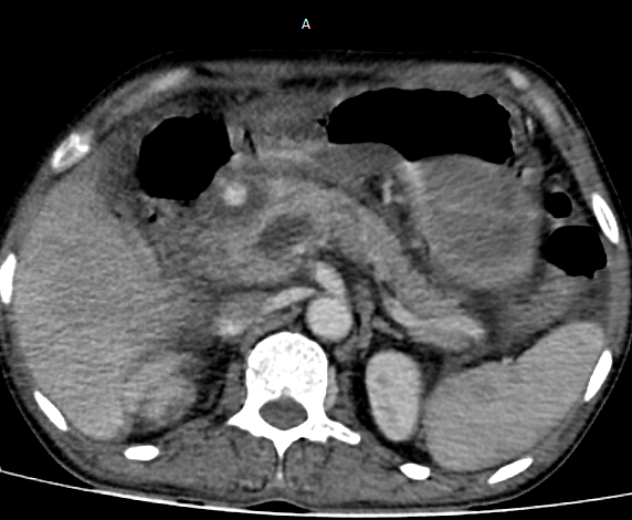 Interventional Radiology BIR, RGGGH@Chennai tweet media