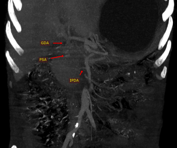 Interventional Radiology BIR, RGGGH@Chennai tweet media