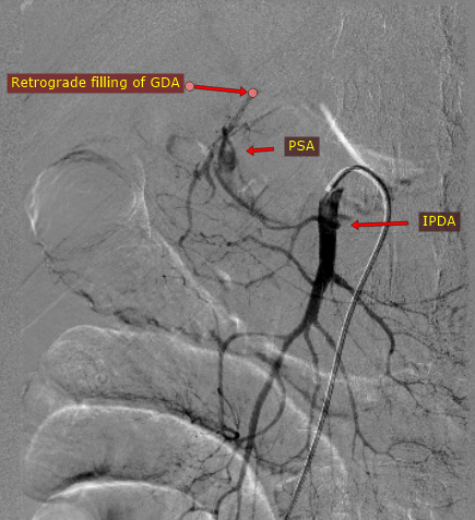 Interventional Radiology BIR, RGGGH@Chennai tweet media
