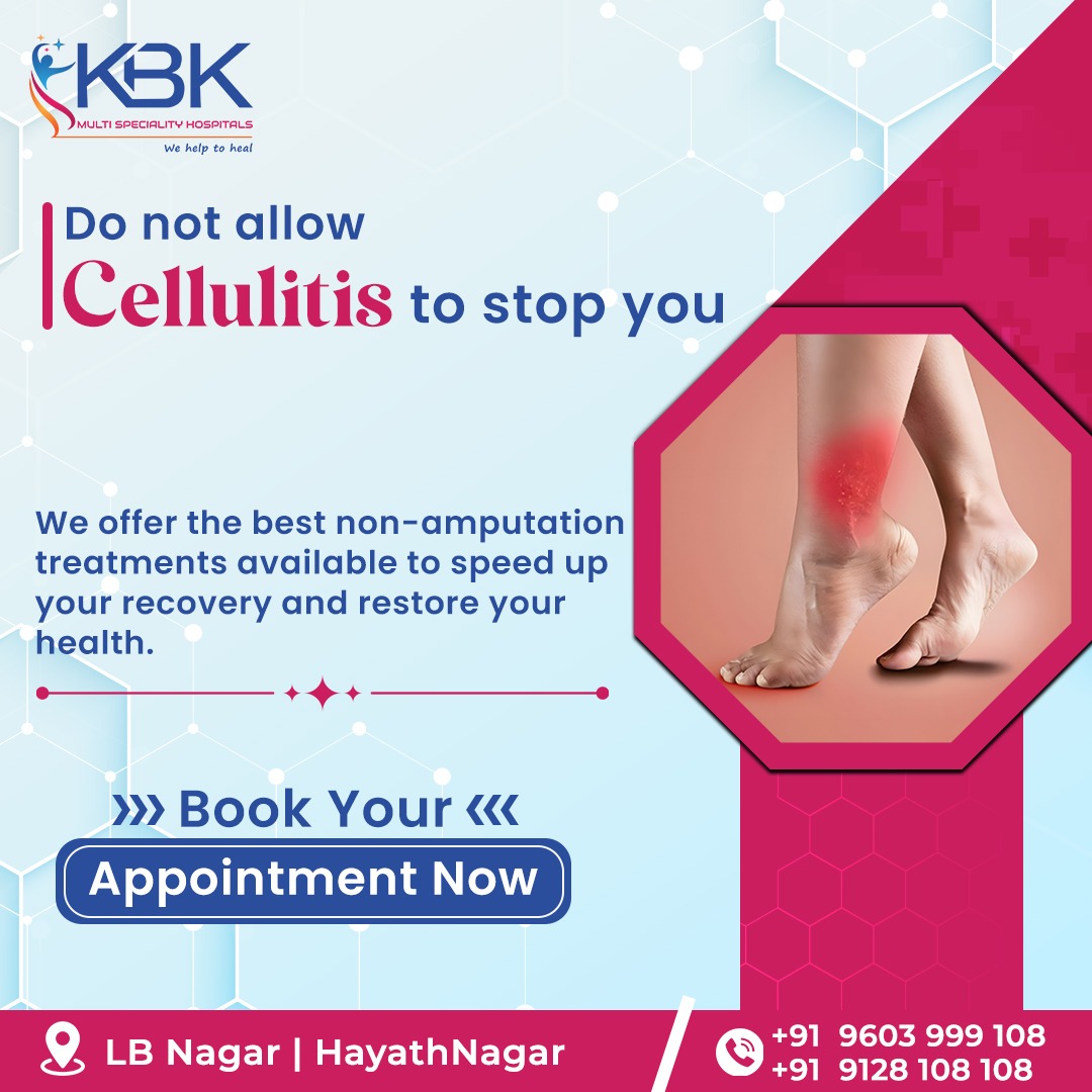 kbkhospitals's tweet photo. Why let cellulitis slow you down when non-amputation treatments await at KBK Hospital? Our revolutionary methods ensure a faster recovery and a healthier you, without the need for surgery.

#kbkhospitals #kbkgroup #besthospital #cellulitis #nonsurgicaltreatment #skincare https://t.co/n53OrIdKvH