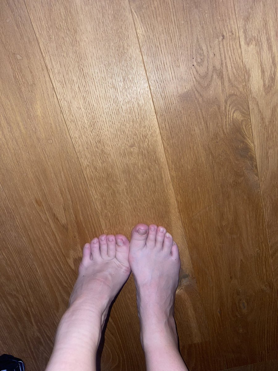 Feet_Finder10's tweet photo. Would you like to see more ? https://t.co/1isVPxfZg5