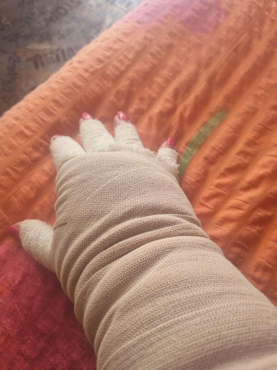 Rokica na terapiji. #limfnadrenaža #soča