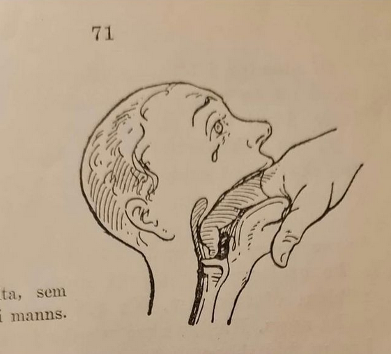 Un livre de cours de premiers secours de 1943 montre comment sauver quelqu'un de l'étouffement
