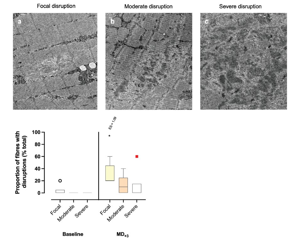 ⚽📊Hamstrings on focus: Are 72 hours sufficient for recovery after a football (soccer) match? A multidisciplinary approach based on hamstring injury risk factors and histology

pubmed.ncbi.nlm.nih.gov/39087576/