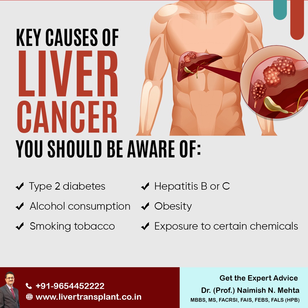 mehta_naimish's tweet image. Key Causes of Liver Cancer You Should Be Aware Of:
- Type 2 diabetes
- Hepatitis B or C
- Alcohol consumption
- Obesity
- Smoking tobacco
- Exposure to certain chemicals

#livercancer #LiverProblem #liverpain #DrNaimishMehta