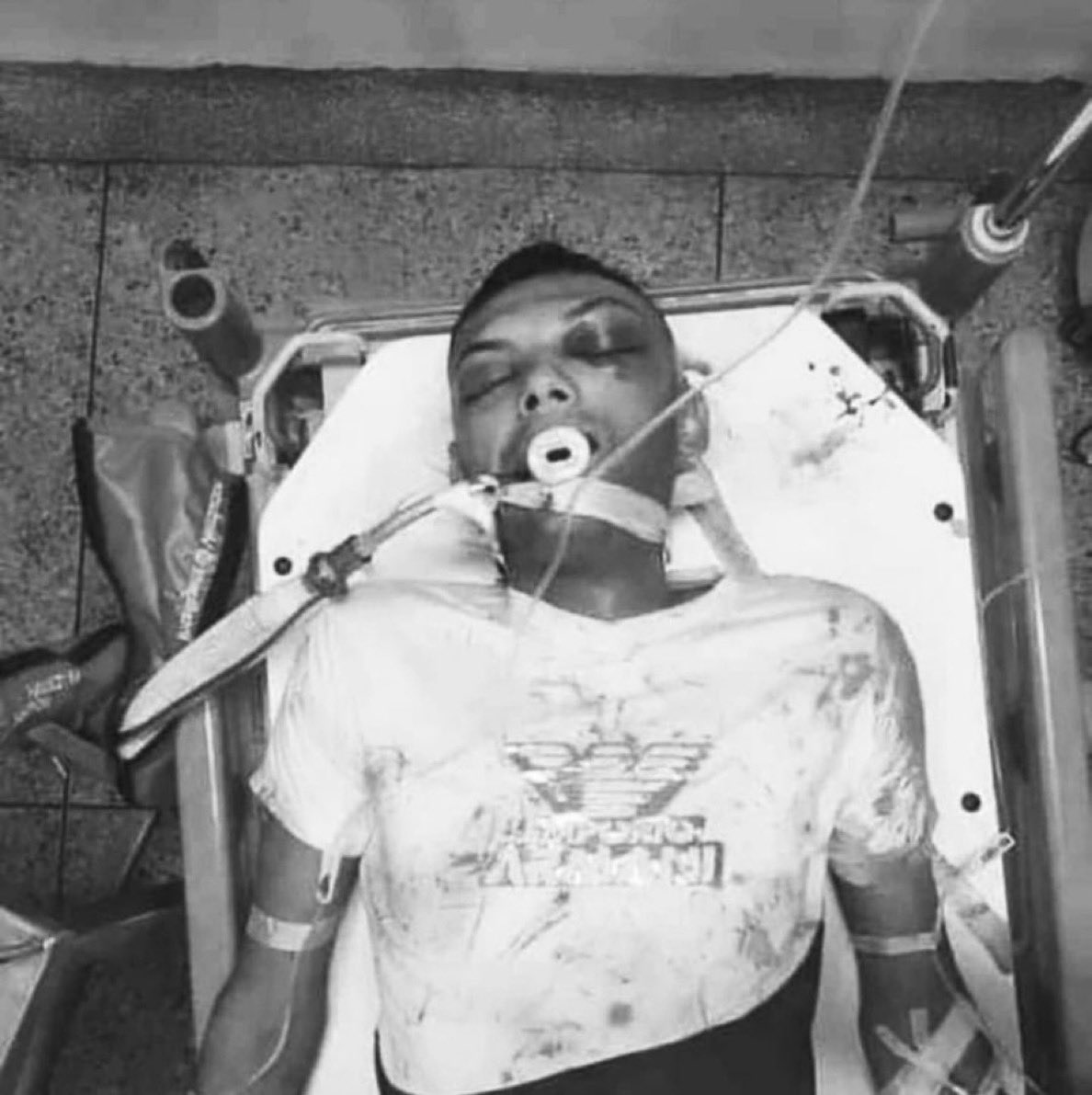 Falleció el joven Ángel Mora brutalmente golpeado por los cuerpos represivos de la dictadura de maduro,quien protestaba pacíficamente en Guanare exigiendo el respeto a los resultados electorales.Otro crimen de lesa humanidad <a href="/KarimKhanQC/">Karim A. A. Khan KC</a>. Es hora que actúe la <a href="/CourPenaleInt/">CPI-Cour pénale int.</a>