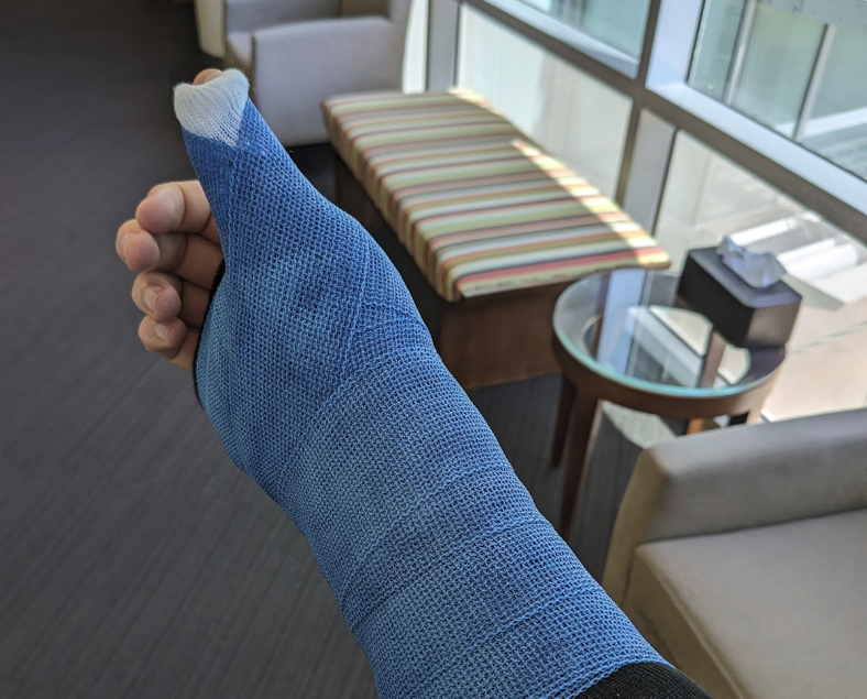 Replacing my right hand with AI

(How I wrote thousands of lines of code for work each week while in a cast)

erikschluntz.com/software/2024/…