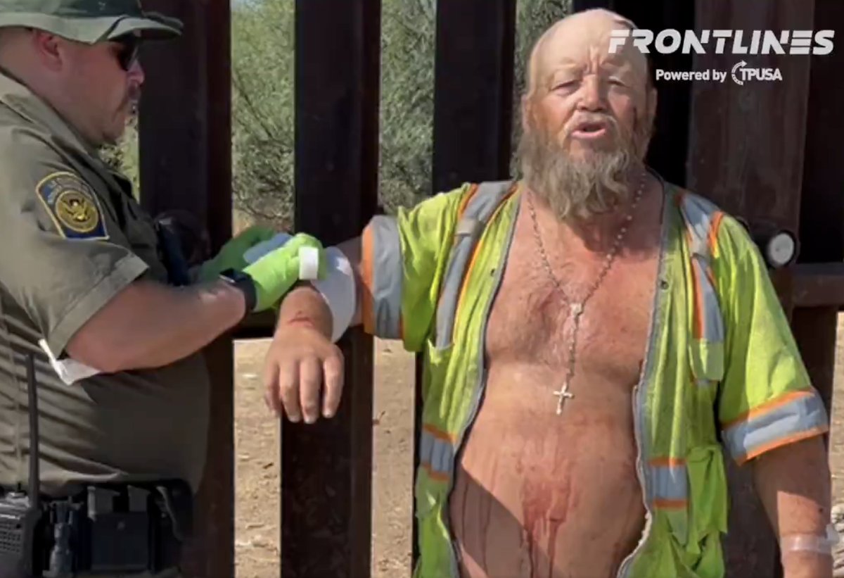 This neighbor did not want us to use his name, but he got bloodied up after confronting a pack of illegal immigrants. The border agents arrived after the fact and patched him up.
