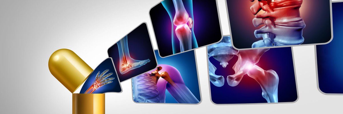 Physician's Weekly (@physicianswkly) on Twitter photo A biomarker panel that includes matrix metalloproteinases-degraded type III collagen and other markers may help assess #PsA flares, according to findings in <a href="/ArthritisRes/">ArthritisResTher</a> by Vinod Chandran, MD, PhD, of <a href="/UofT_DoM/">Department of Medicine University of Toronto</a>.
Learn more here: buff.ly/3WyRdHB
#SoMeDocs #MedTwitter A biomarker panel that includes matrix metalloproteinases-degraded type III collagen and other markers may help assess #PsA flares, according to findings in <a href="/ArthritisRes/">ArthritisResTher</a> by Vinod Chandran, MD, PhD, of <a href="/UofT_DoM/">Department of Medicine University of Toronto</a>.
Learn more here: buff.ly/3WyRdHB
#SoMeDocs #MedTwitter