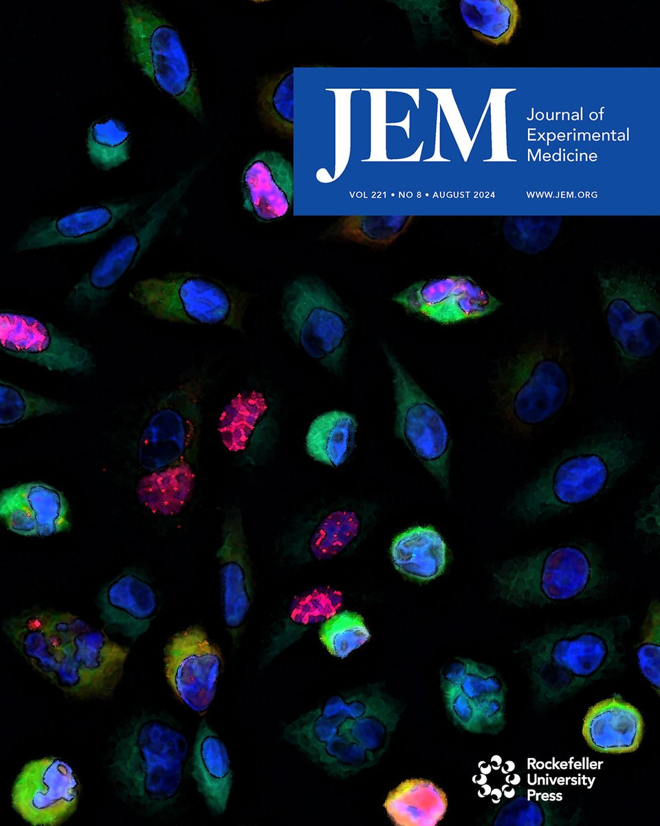 Journal of Experimental Medicine (@jexpmed) on Twitter photo Our August issue is out! hubs.la/Q02JTSw30. The cover shows HSV-1 infection inhibiting ASC speck formation in an A549 cell line. ASC-GFP is in green, ICP0 from HSV-1 is in red, & cell nuclei are in blue. From <a href="/JustKOS1/">Pooja Parameswaran</a> <a href="/VirulentMind/">Megan Orzalli</a> et al. hubs.la/Q02JTy5C0 Our August issue is out! hubs.la/Q02JTSw30. The cover shows HSV-1 infection inhibiting ASC speck formation in an A549 cell line. ASC-GFP is in green, ICP0 from HSV-1 is in red, & cell nuclei are in blue. From <a href="/JustKOS1/">Pooja Parameswaran</a> <a href="/VirulentMind/">Megan Orzalli</a> et al. hubs.la/Q02JTy5C0