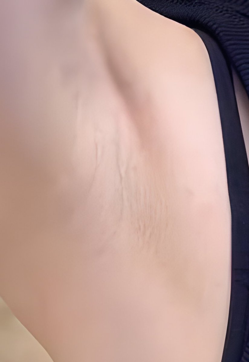 #sexyarmpits #armpit #armpits #hotarmpits #armpitlover #armpitgirl #kilikili #ketek #ketiak #lickarmpit #腋 #腋下 #腋フェチ #脇フェチ #脇の下 #ワキ #素人 #女子 #可愛い #美女 #お姉さん