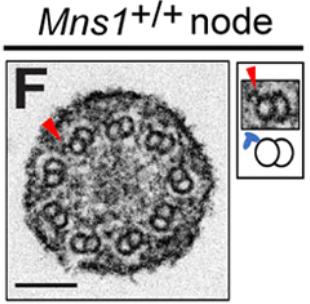 focalplane_jcs's tweet photo. For #EMmonday, we’re highlighting an EM favourite, cilia! Hao Lu, Wang Kyaw Twan, Yayoi Ikawa, Vani Khare, Hiroshi Hamada, Sudipto Roy &amp; colleagues find that ODAs are lost from Mns1 mutant mouse (9+0) nodal cilia.
📖@dev_journal: https://t.co/I9vAmmjKn4 https://t.co/RjLuP14CMa