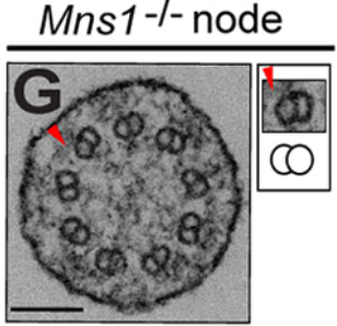 focalplane_jcs's tweet photo. For #EMmonday, we’re highlighting an EM favourite, cilia! Hao Lu, Wang Kyaw Twan, Yayoi Ikawa, Vani Khare, Hiroshi Hamada, Sudipto Roy &amp; colleagues find that ODAs are lost from Mns1 mutant mouse (9+0) nodal cilia.
📖@dev_journal: https://t.co/I9vAmmjKn4 https://t.co/RjLuP14CMa