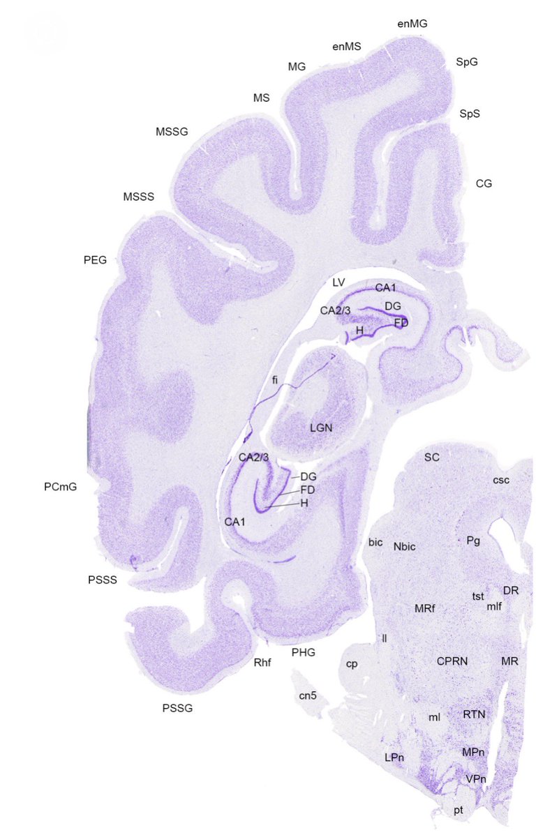 Hecht Lab (@labhecht) on Twitter photo We’re hiring! Come join us in <a href="/HarvardHEB/">Harvard Department of Human Evolutionary Biology</a> to investigate brain-behavior evolution in dogs, other canids, humans, & other primates. Seeking expertise in histology & microscopy. 🔬
Postdoc: academicpositions.harvard.edu/postings/13832
Full-time staff: sjobs.brassring.com/TGnewUI/Search… We’re hiring! Come join us in <a href="/HarvardHEB/">Harvard Department of Human Evolutionary Biology</a> to investigate brain-behavior evolution in dogs, other canids, humans, & other primates. Seeking expertise in histology & microscopy. 🔬
Postdoc: academicpositions.harvard.edu/postings/13832
Full-time staff: sjobs.brassring.com/TGnewUI/Search…
