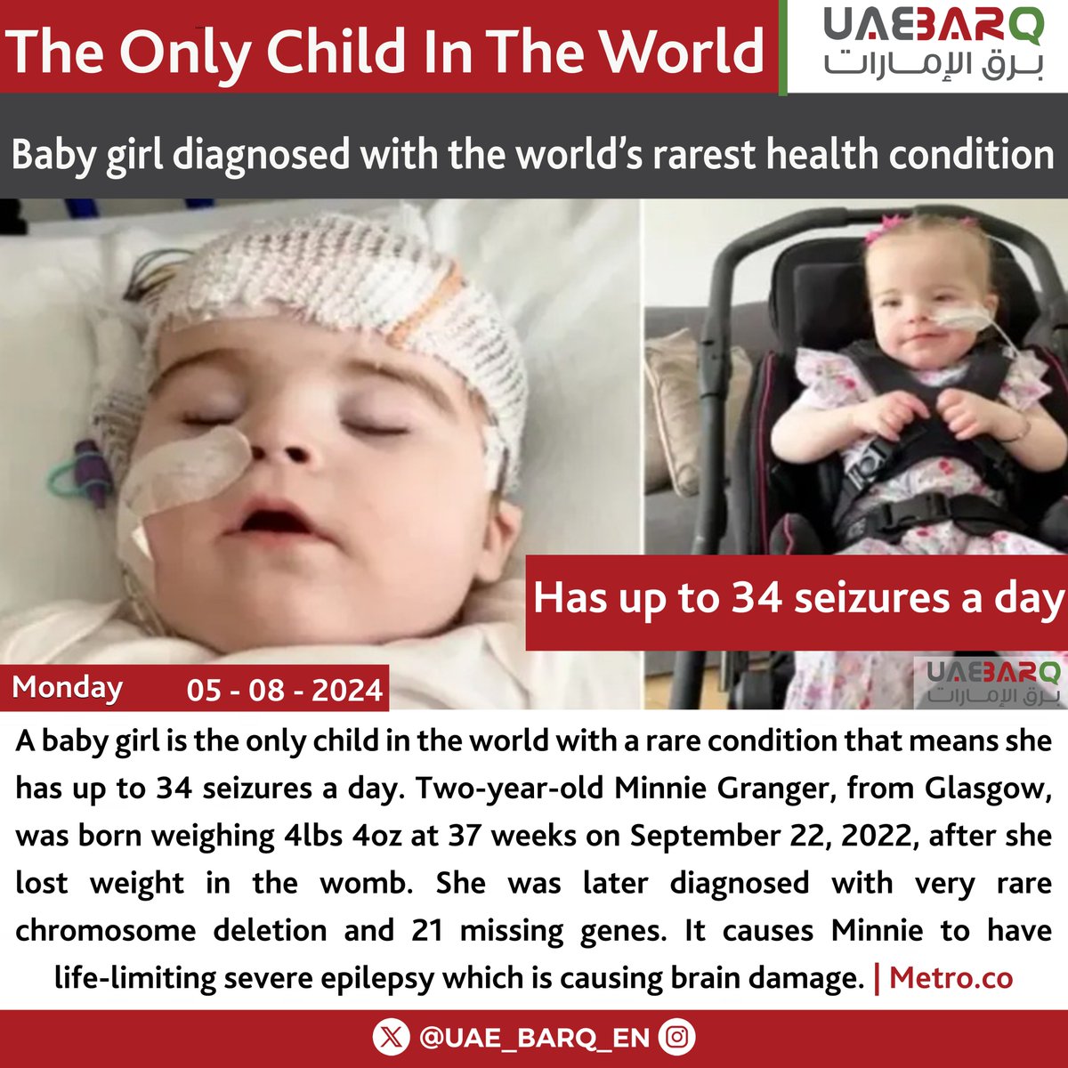 UAE_BARQ_EN's tweet image. Baby girl diagnosed with the world’s #rarest health condition. 

#UAE_BARQ_EN
