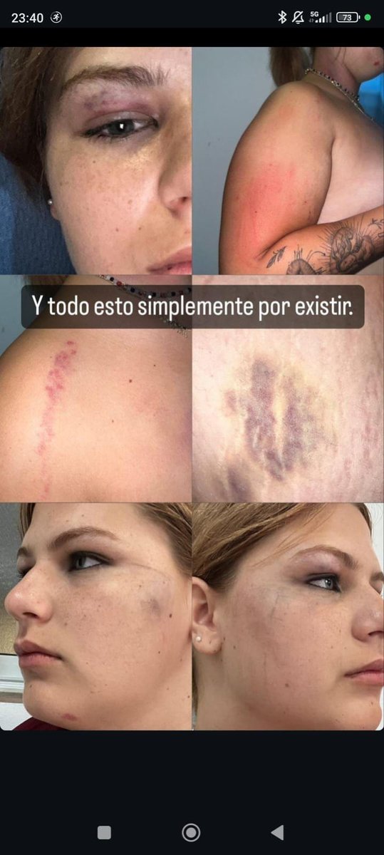 Edur_LH's tweet photo. Nuevas y graves agresiones a mujeres trans en Chipiona (Cádiz) y Valencia.
Pedimos colaboración para identificar a los autores de estos CRIMENES DE ODIO FASCISTA. Los discursos tránsfobos, como los oídos mil veces estos días, tienen estas consecuencias
Hasta cuando, @interiorgob? https://t.co/BX1fPztwQA