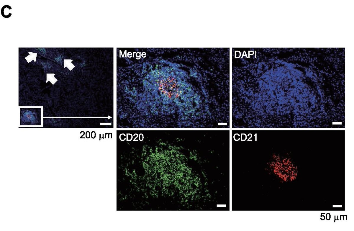 Good guy T cells: PD1+CD4+ T cells promote receptor editing and suppress autoreactivity of B cells during  #pneumonia mucosalimmunology.org/article/S1933-…