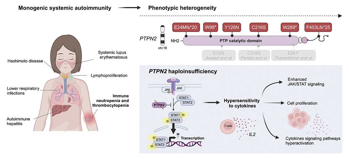 Journal of Experimental Medicine (@jexpmed) on Twitter photo Findings from @JEANPIERRMarie, <a href="/CgdJade/">Jade Cognard</a>, @FRLab1, <a href="/AlexandreBelot/">Belot Alexandre</a> et al. suggest that PTPN2 along with SOCS1 haploinsufficiency constitute a new group of monogenic autoimmune diseases that can benefit from targeted therapy. hubs.la/Q02Hvg8z0
#lupus #autoimmunity Findings from @JEANPIERRMarie, <a href="/CgdJade/">Jade Cognard</a>, @FRLab1, <a href="/AlexandreBelot/">Belot Alexandre</a> et al. suggest that PTPN2 along with SOCS1 haploinsufficiency constitute a new group of monogenic autoimmune diseases that can benefit from targeted therapy. hubs.la/Q02Hvg8z0
#lupus #autoimmunity