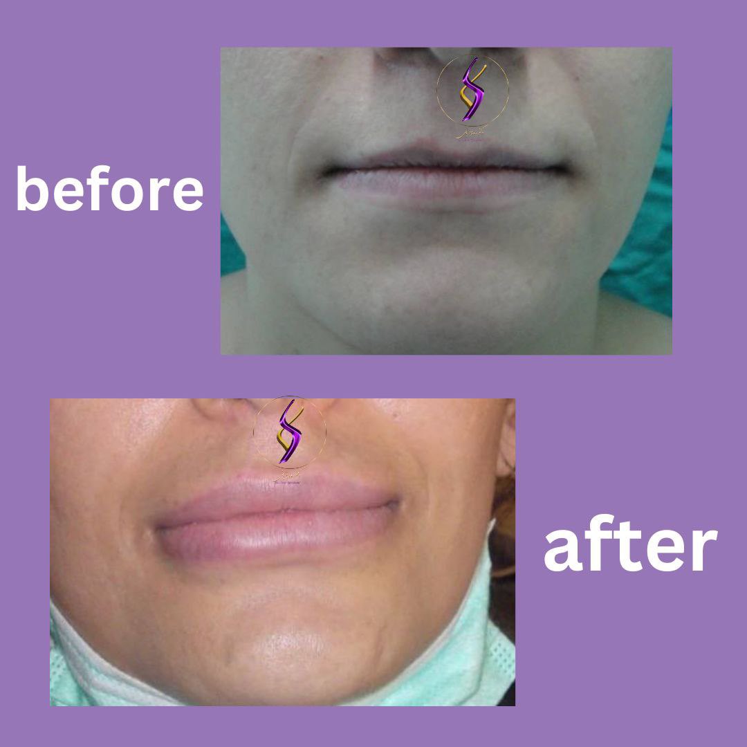 Dr.Sara Ghorbani tweet media