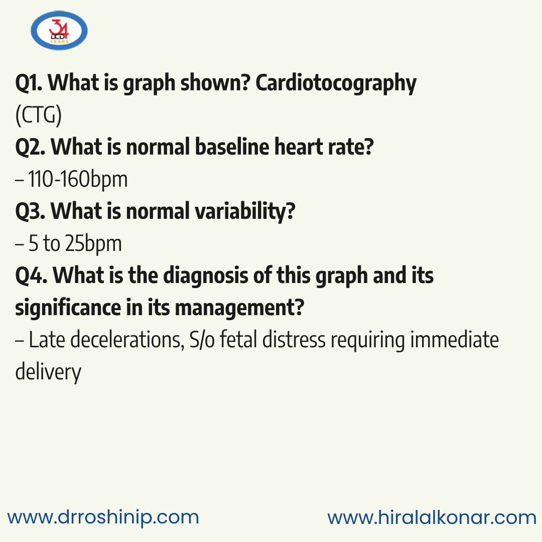DCDuttaBooks's tweet photo. Q1. What is graph shown? (1marks)
Q2. What is normal baseline heart rate? (1marks)
Q3. What is normal variability? (1marks)
Q4. What is the diagnosis of this graph and its significance in its management? (2marks)

Follow us to learn more.

Reference:
https://t.co/RxcI42ejYY https://t.co/jFrPhNMbZJ