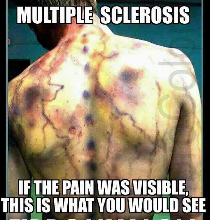 EndMsNow's tweet image. #MSconnections #MSNetwork #MSCommunity #WeHaveMS #URNotAlone 
#ShiftMS 
#CureMS 
#Chronicillness 
#WeGetIt
#Ms is kicking my ass right now. It&apos;s no longer enough to use a cane. It&apos;s only a matter of time before I am going to need a walker. I&apos;m screwed if that happens #MsAwarness