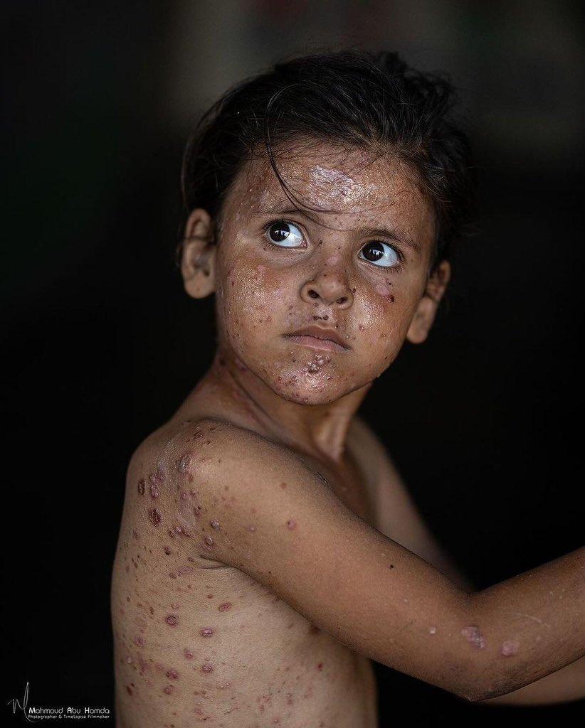 Çocuklar acı içindeyken hangi ırktan olduğuna bakanlar, insan kimliği için 'hükümsüzdür' ilanı versin.

#Gaza