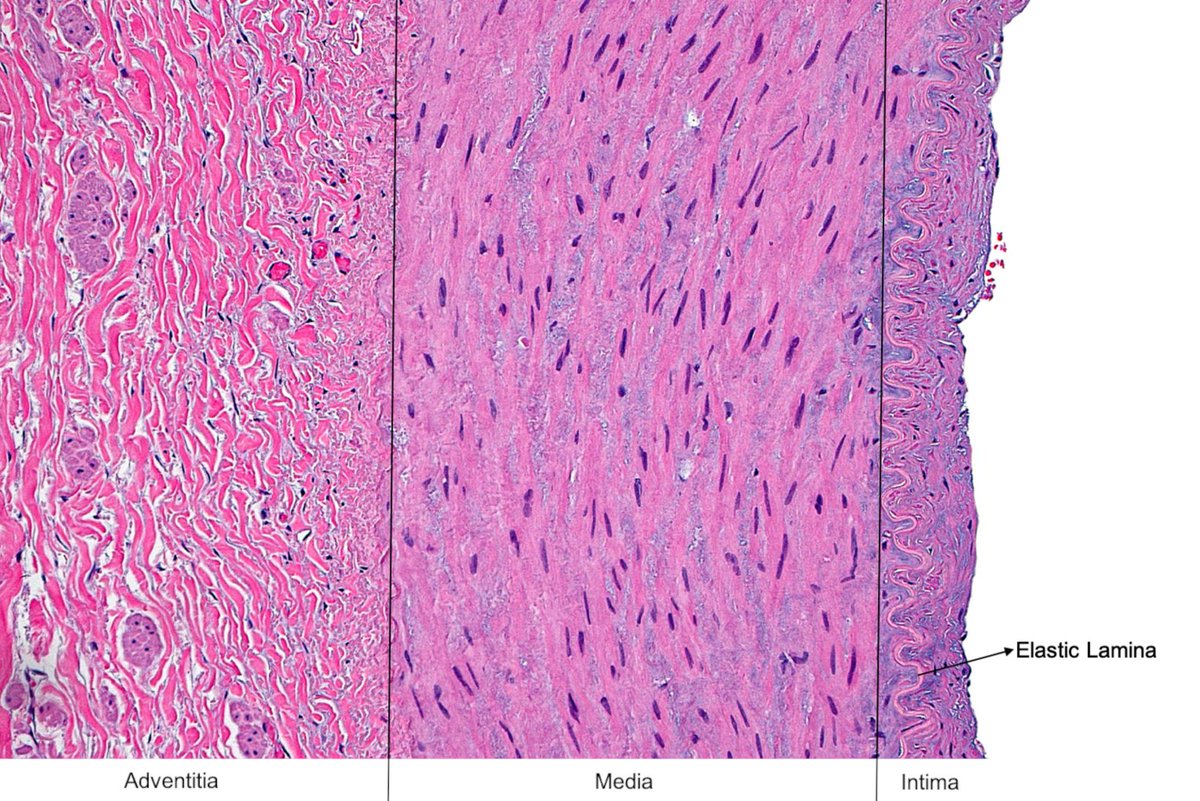 Labeled layers of an arterial wall ~ #histology #pathology #cardiovascular