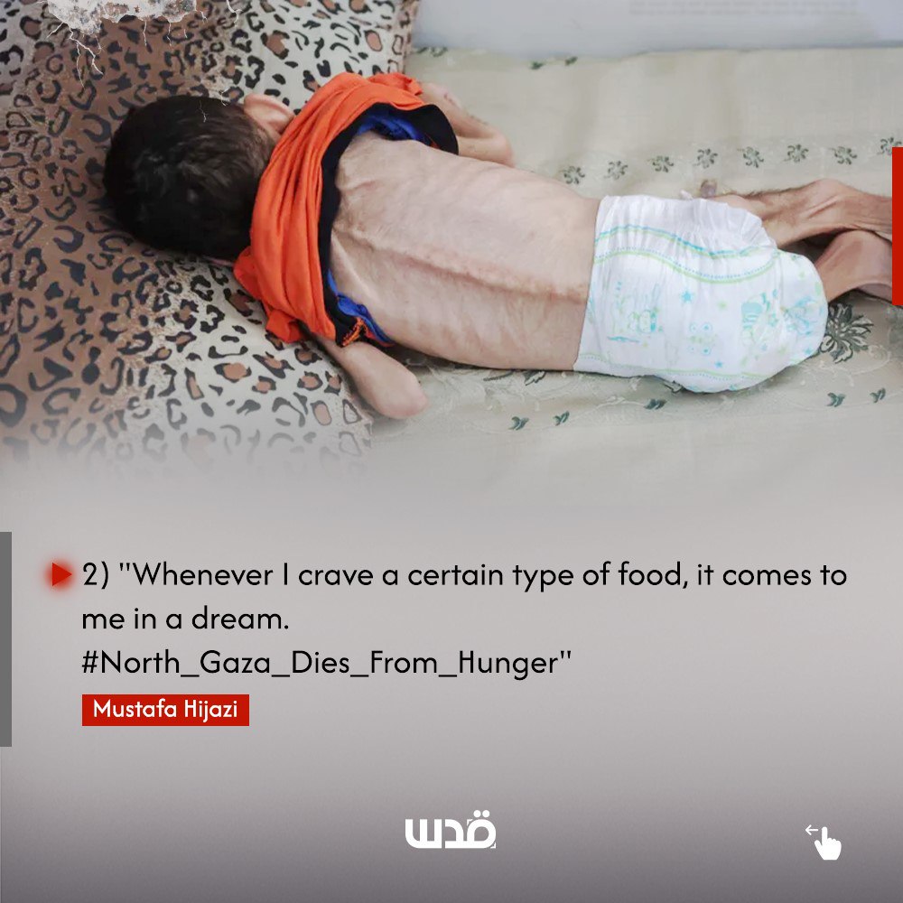 QudsNen's tweet photo. "Whenever I crave a certain type of food, it comes to me in a dream.  #North_Gaza_Dies_From_Hunger"

-Mustafa Hijazi https://t.co/6eKTPbKA8W