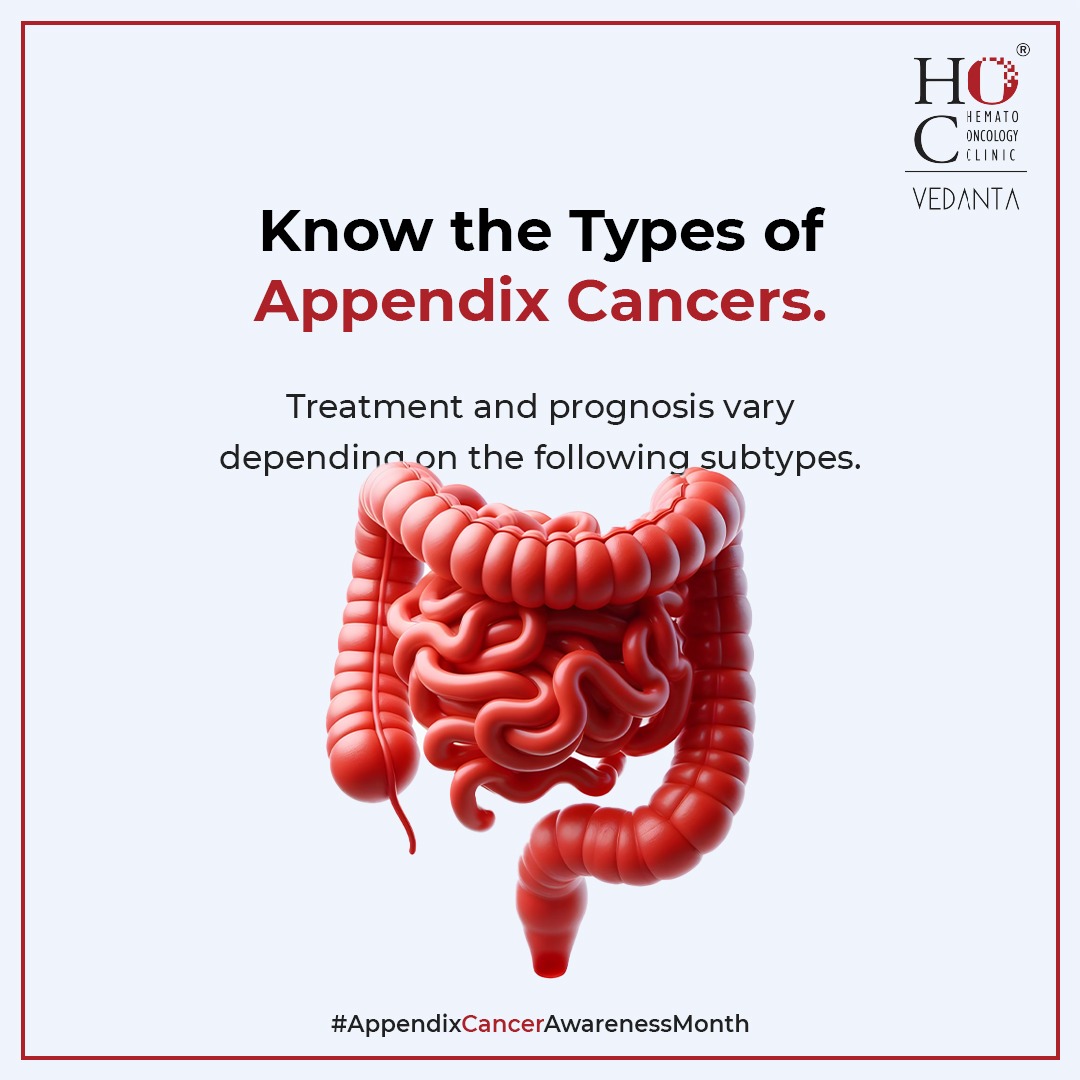 HocVedanta's tweet image. Appendix cancers can come in various forms - each with its own treatment path. Recognising these types can make all the difference in your health journey. #AppendixCancerAwarenessMonth
.
.
.
.
#hocvedanta #hoccancerhospital #hoc #cancercare #cancersupport #healthtips