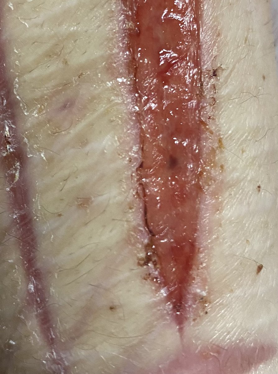 corpse_bunnyy's tweet photo. TW SHTWT // wtf is that creepy dark speck in my cut https://t.co/B7gPYuJTlw