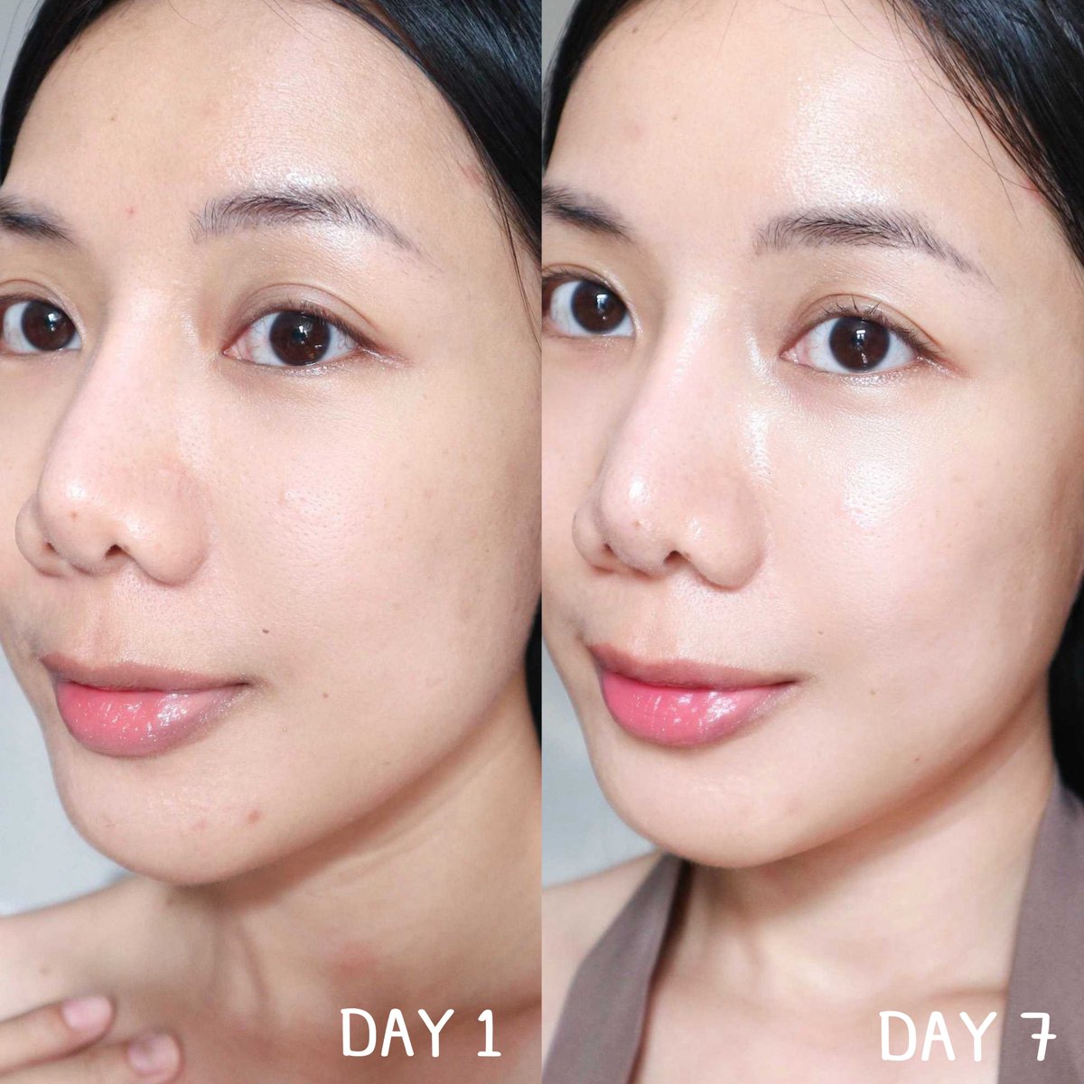 มาสก์ SKIN1004 ชอบมากต้องมีติดไว้ใช้ตลอด มาสก์ติดต่อกันวีคนึงผิวโกลว์สุดๆลดผิวระคายเคืองดีมาก ผิวแข็งแรงขึ้น!
 แอมพูลฉ่ำๆเต็มแผ่นเต็มซองยังกะใส่มาทั้งขวด มาสก์คืนเดียวเช้ามาผิวฟู อิ่มน้ำเร่งด่วนบูสผิวไวมี HyaComplex ถึง 3 ชนิด👍🏻
ใช้มาสก์ทุกวันได้สบายๆ 
#Skin1004OriginalThailand   #รีวิวSKIN1004