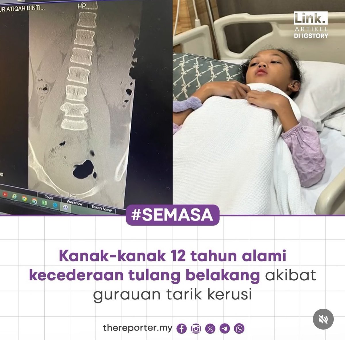 AkeemSharyzal's tweet photo. Berapa kali nak pesan, benda bodoh camni jangan buat main, effect dia seumur hidup. https://t.co/ba1rxOjgcH