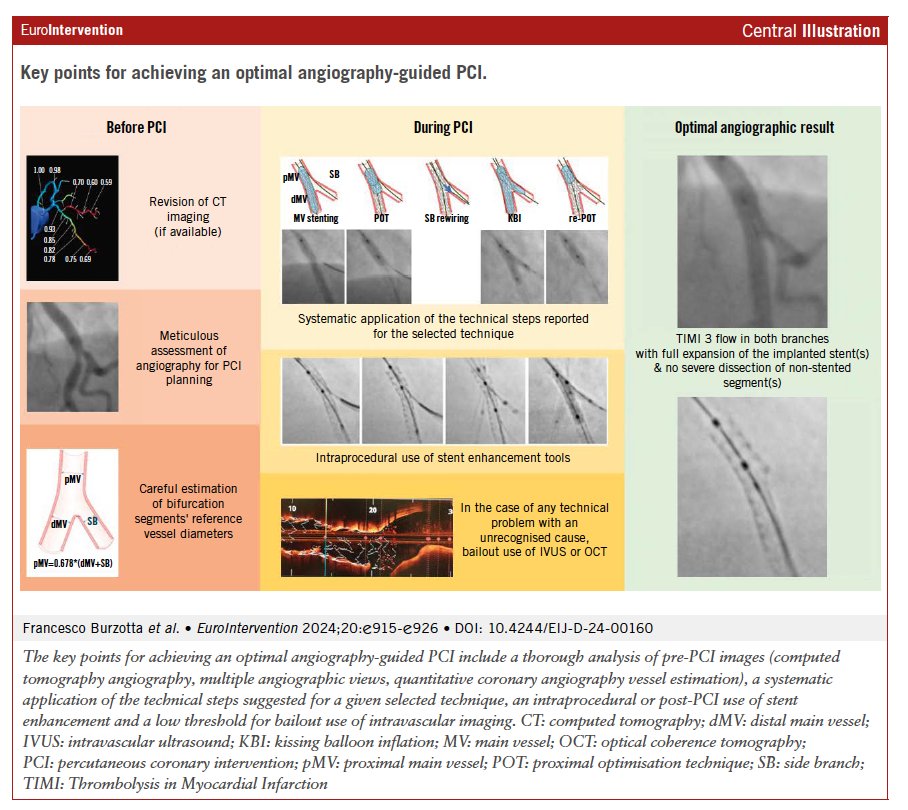 EuroIntervention (@eurointerventio) on Twitter photo The 18th European Bifurcation Club document highlights optimized angiographic guidance for percutaneous coronary interventions on bifurcation lesions. Learn the latest strategies for angiography-guided PCI including tips for success. <a href="/BURZOTTA_F/">FRANCESCO BURZOTTA</a> #EAPCI ow.ly/lTJv50SRMIC The 18th European Bifurcation Club document highlights optimized angiographic guidance for percutaneous coronary interventions on bifurcation lesions. Learn the latest strategies for angiography-guided PCI including tips for success. <a href="/BURZOTTA_F/">FRANCESCO BURZOTTA</a> #EAPCI ow.ly/lTJv50SRMIC