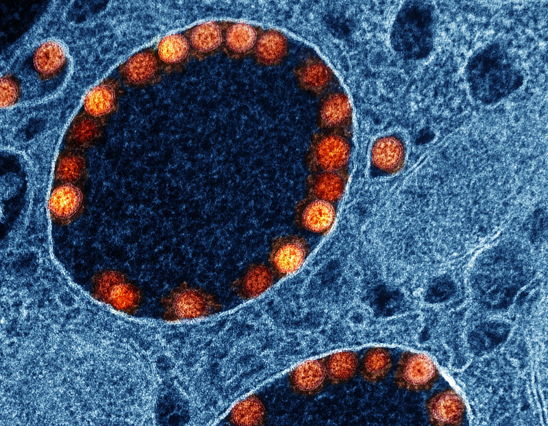 NIAID News (@niaidnews) on Twitter photo Adding mRNA that encodes immune protein IL-12 to an mRNA #COVID19 vaccine raised vaccine immune responses in aged mice to levels akin to those in younger mice, #NIAID-funded researchers report. Learn more: science.org/doi/10.1126/sc…
#NIH #science #research #immunology
<a href="/ScienceTM/">Science Translational Medicine</a> Adding mRNA that encodes immune protein IL-12 to an mRNA #COVID19 vaccine raised vaccine immune responses in aged mice to levels akin to those in younger mice, #NIAID-funded researchers report. Learn more: science.org/doi/10.1126/sc…
#NIH #science #research #immunology
<a href="/ScienceTM/">Science Translational Medicine</a>