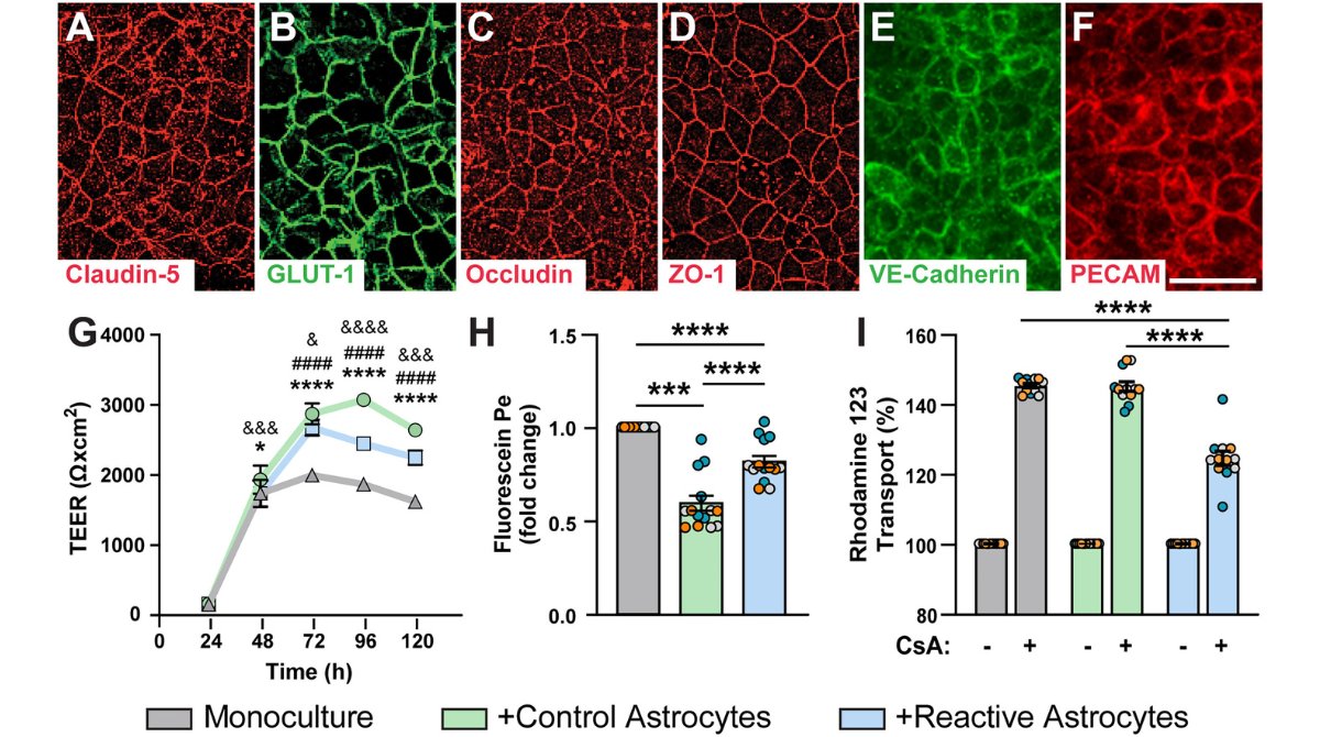 stemcellreports's tweet image. New research from @catiasvgomes at the @meyerlab: Induction of astrocyte reactivity promotes neurodegeneration in human pluripotent stem cell models #astrocyte #reactivity 

@IUMedSchool @NeurosciStark @ISSCR @CellPressNews @MartinPeraJAX 

ow.ly/uRhn50SRbzR