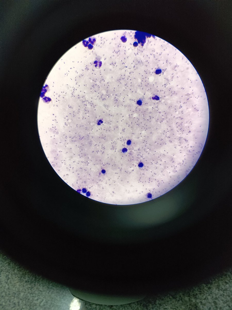 Dear Medical Laboratory Scientists, 

Yesterday, I received a sample for a 9month old baby that had surgery some days ago, and the requested investigations were FBC, CRP and Procalcitonin, and here are highlights of the results; WBC 12,300, Neutrophil 72% HB 10.9, HCT 33%, PLT