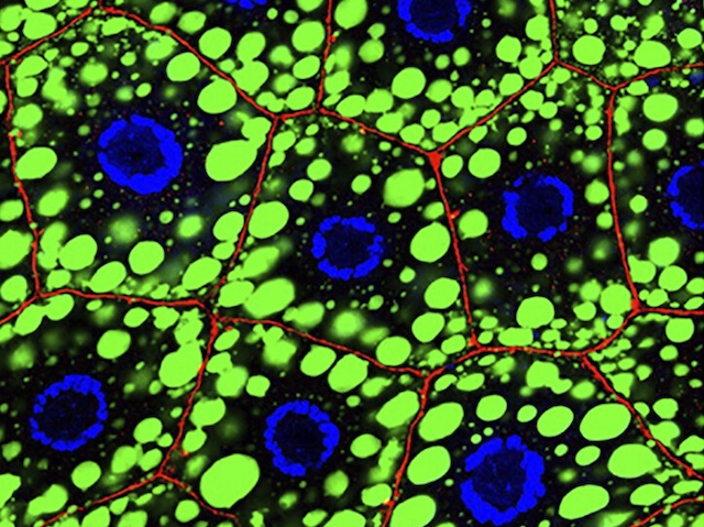 Biomedical Picture of the Day BPoD (@bpod_s) on Twitter photo #Wnt's vital in many cell functions. Study in #drosophila shows activation reduces #fat accumulation: insight into fat #metabolism. Image & research Mengmeng Liu & Rajitha-Udakara-Sampath Hemba-Wadug et al <a href="/CancerLouisiana/">Louisiana Cancer Research Center</a> <a href="/TulaneMedicine/">Tulane Medicine</a> in <a href="/PNASNews/">PNASNews</a>. On bpod.org.uk/archive/2024/8… #Wnt's vital in many cell functions. Study in #drosophila shows activation reduces #fat accumulation: insight into fat #metabolism. Image & research Mengmeng Liu & Rajitha-Udakara-Sampath Hemba-Wadug et al <a href="/CancerLouisiana/">Louisiana Cancer Research Center</a> <a href="/TulaneMedicine/">Tulane Medicine</a> in <a href="/PNASNews/">PNASNews</a>. On bpod.org.uk/archive/2024/8…