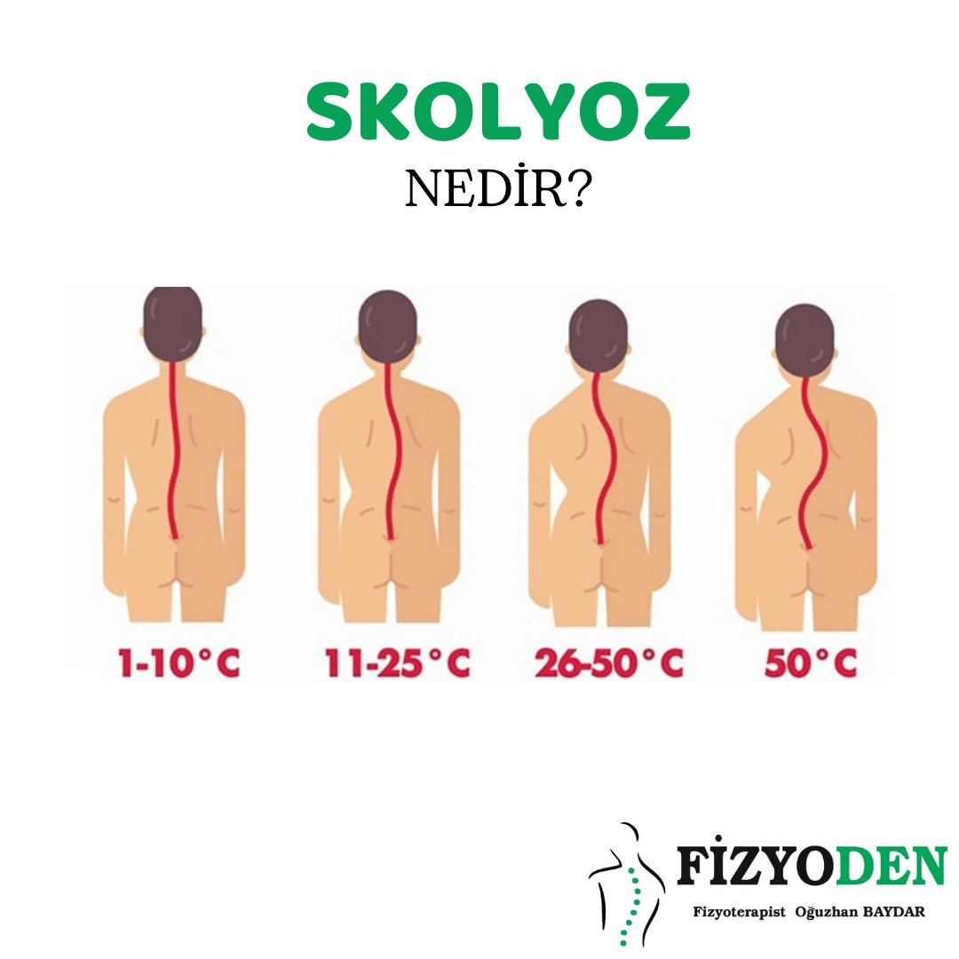 Detaylı bilgi ve randevu için arayabilirsiniz.
📞0 553 272 25 27