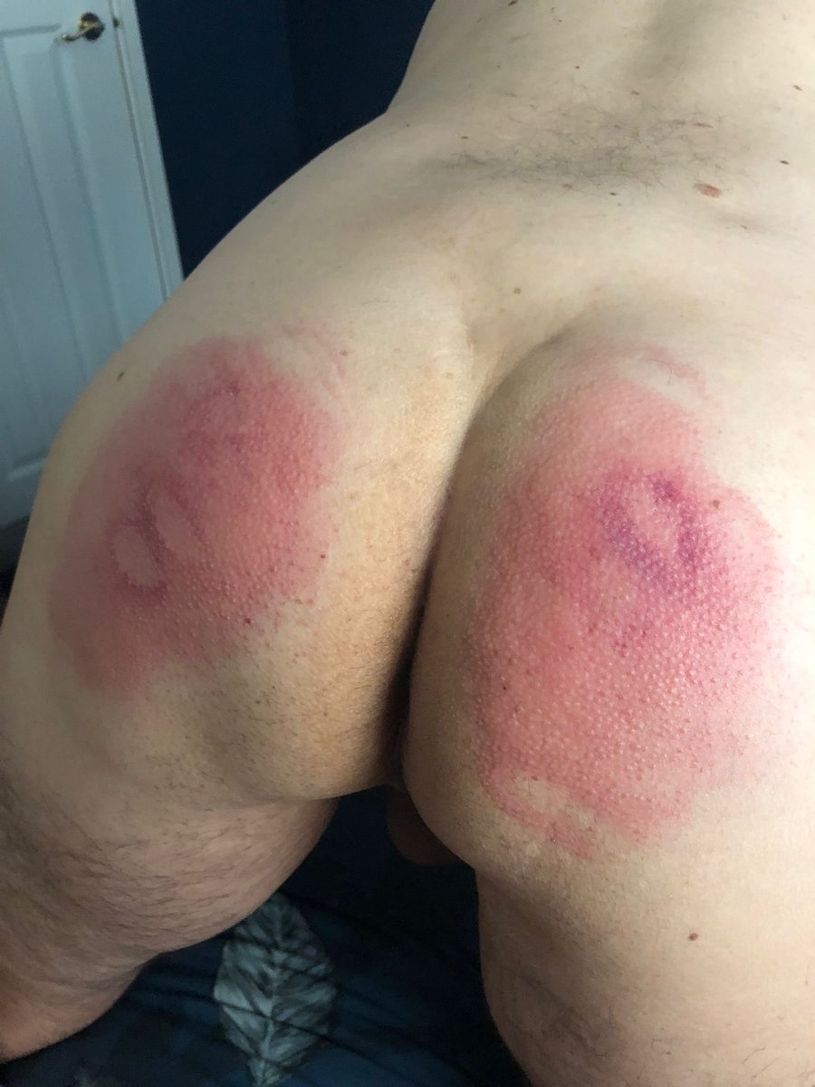 Jake_UKUK's tweet photo. A good spanking for Jake - he loves to receive the wooden spoon.! Anybody else like to punish his soft sweet cheeks.? #spank #bdsm #submissive @SpankMeSilly @LovingBDSM @vipbdsmporn @bdsm @FetLife https://t.co/UoOS7aVpfh