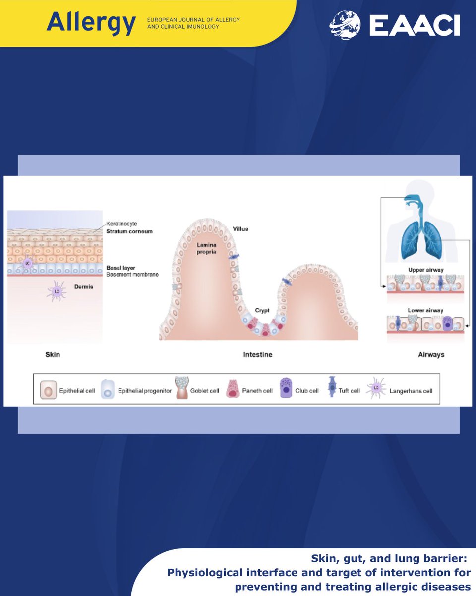 Epithelial barriers in the skin, gut, and airways are vital for immune responses. This review explores their role in allergies and inflammation, the impact of exposome and microbiome, and treatments. Discover the latest understandings! #AllergyEaaci
doi.org/10.1111/all.16…