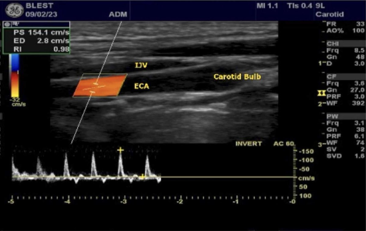 New #ArticlesInPress: The Effect of Different Breathing Conditions on Cerebral Blood Flow in Young Males During Maximal Aerobic Exercise: A Pilot Study

Moris et al.

🔗bit.ly/4daGp9Q

#AEHS