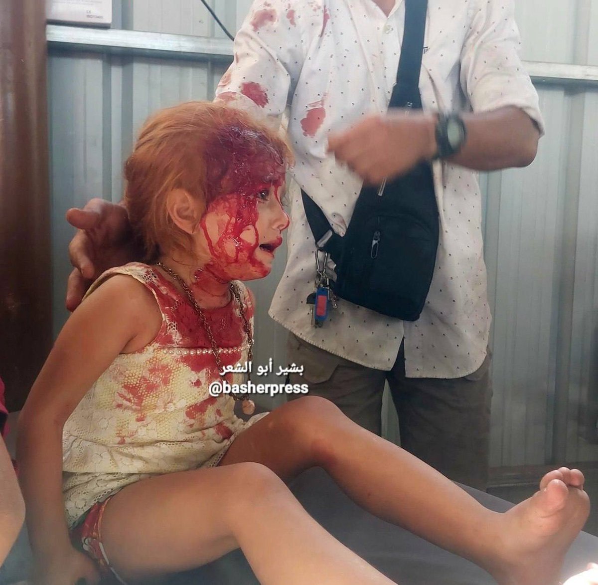 swilkinsonbc's tweet image. A little Palestinian girl was injured &amp;amp; traumatised by the israelis in their sadistic air strike in Gaza — she’s one of the israeli regime’s key target