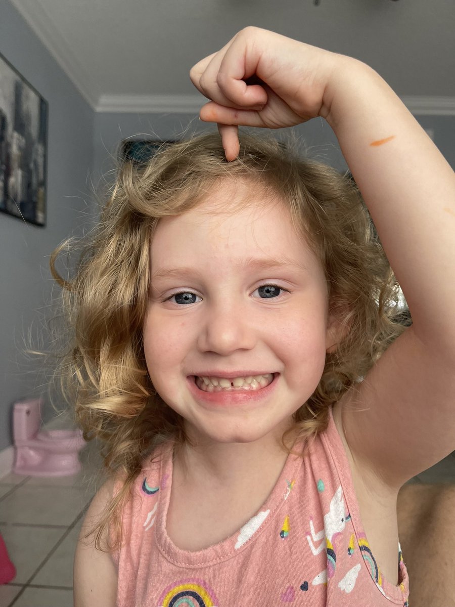 ThatFinsRealtor's tweet image. Well guys, MIBG confirms the cancer is once again active. 

Alaina is going into surgery tomorrow for debulking. Hopefully they can resect the majority of it so this will be an easier road. Still have to biopsy the tumor upon removal 

Thank you all for the continued prayers 🙏…