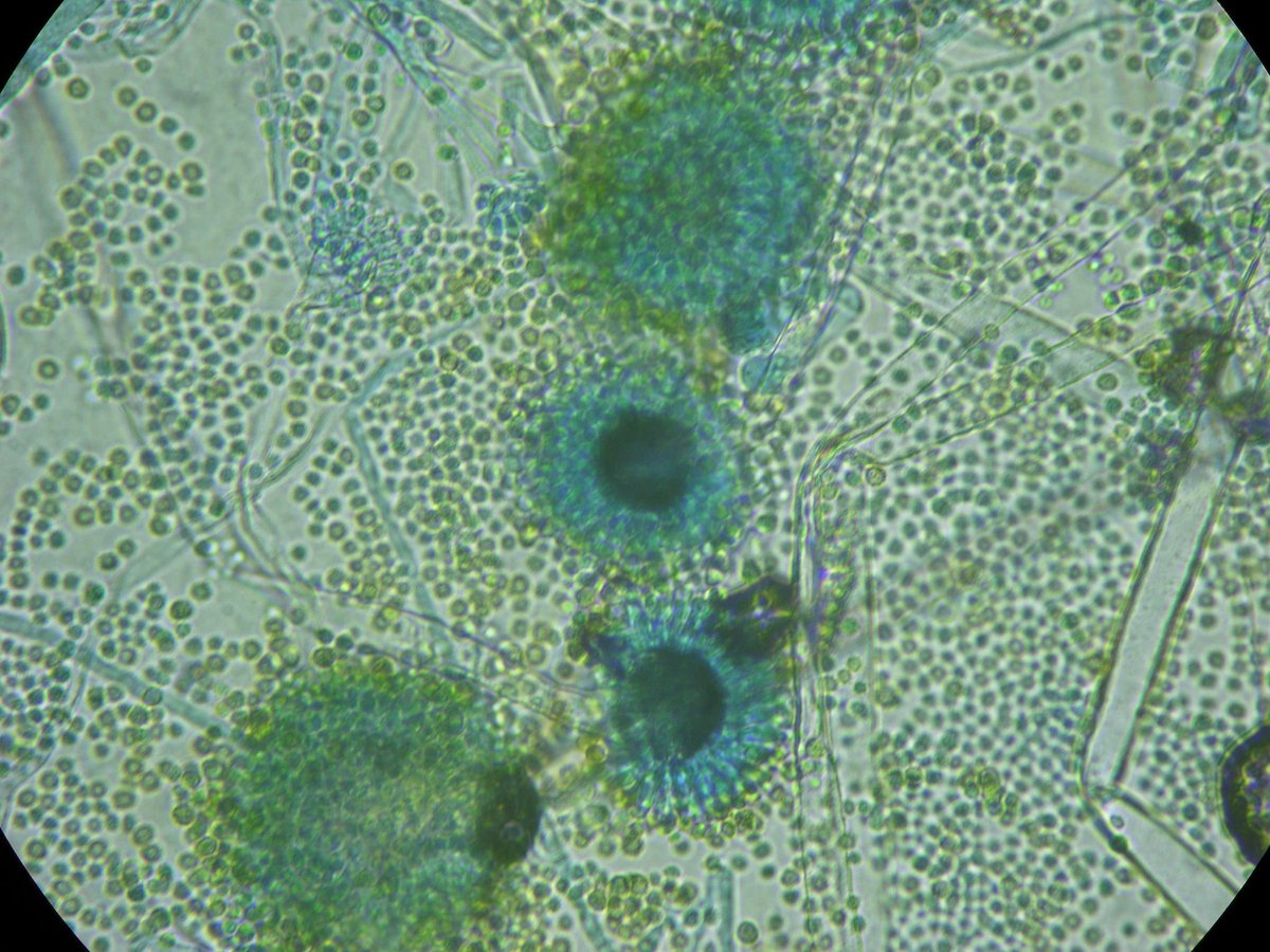 Aspergillus tamarii (flavus group) grown in an air sample during hospital works. Few conidia can settle in the dust, germinate and generate millions in one day or two. It is wise to get rid of the dust frequently. #airsampling #fungi #ambientcontrol #aerobiology  #airquality