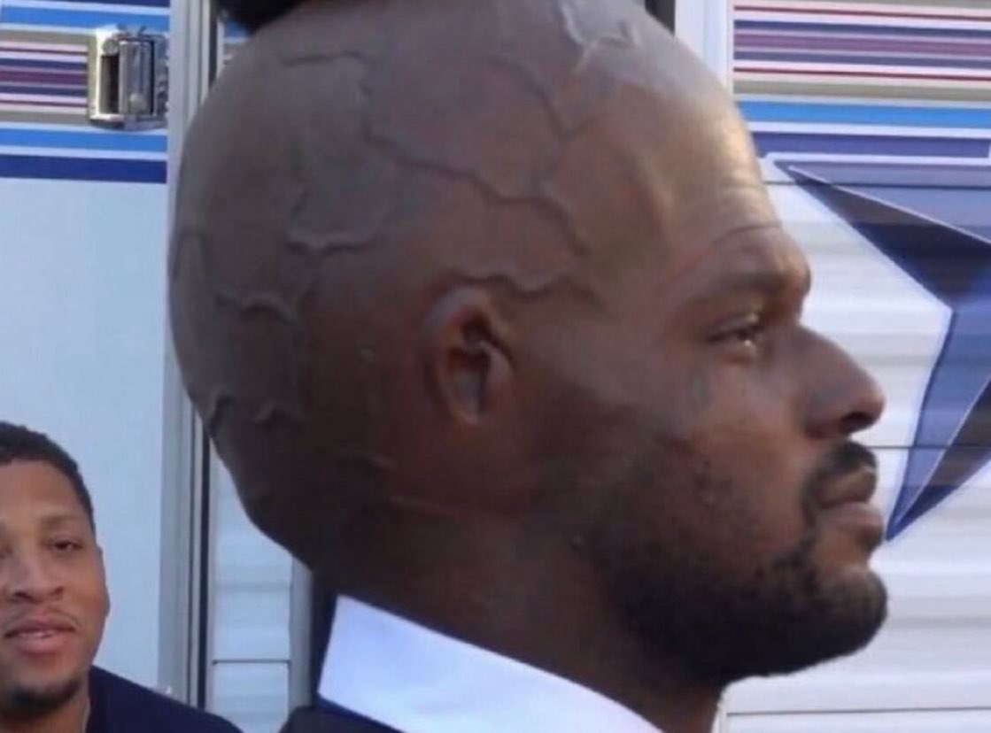 Whotfismick's tweet image. when I say my head POUNDING like a mf this what I mean.