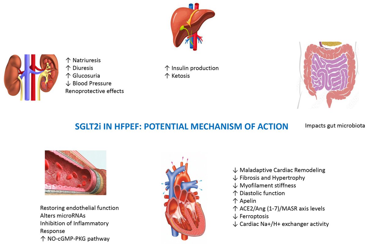 ZHeart11768530's tweet photo. 🔴Distinct Profiles and New Pharmacological Targets for HFpEF #2024Review #OpenAccess
🔹https://t.co/WQcBBtQril
#EKG #Multifocal #ECG #Cardiology #MAT #Atrial #Tachycardia #Diagnosis #comparison #electrocardiogram #Arrhythmias #ekg #clinical #ekg #diagnosis #tachycardia https://t.co/NKgfXaArqX