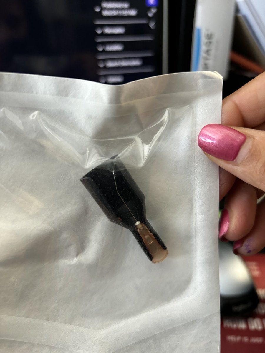 Cannulas are finally in for inserting PRP into meibomian glands for dry eye disease.