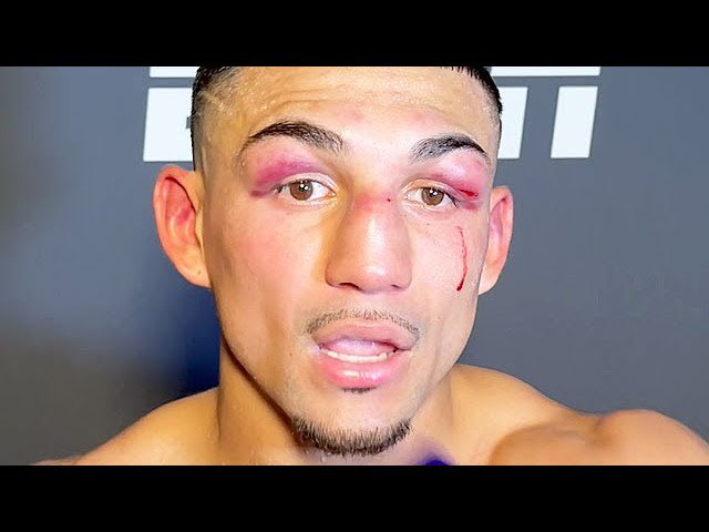 ElonMuskXD644's tweet photo. No offense to you but if Kambosos and Clagget did this to you why in the world would we want to see you fight Bud Crawford? You beat Josh Taylor who I thought lost the first fight to Katteral, and you beat a Loma with a torn shoulder You and Berlanga are similar yall ok with getting stopped for a bag, but the fans don’t want this fight.