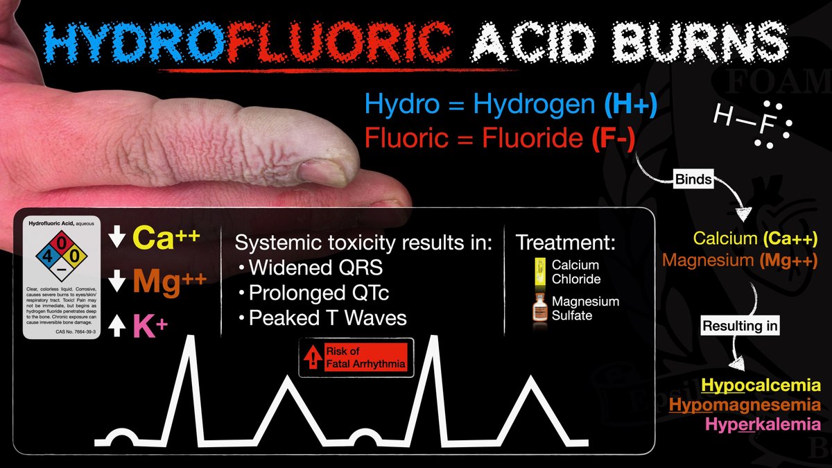 FOAMfrat's tweet photo. Hydrofluoric Acid Burns

HF burns can lead to severe systemic toxicity. When HF binds with Ca and Mg, it can cause hypo Ca, hypo mag, and hyper k. https://t.co/GgOS87UAh8